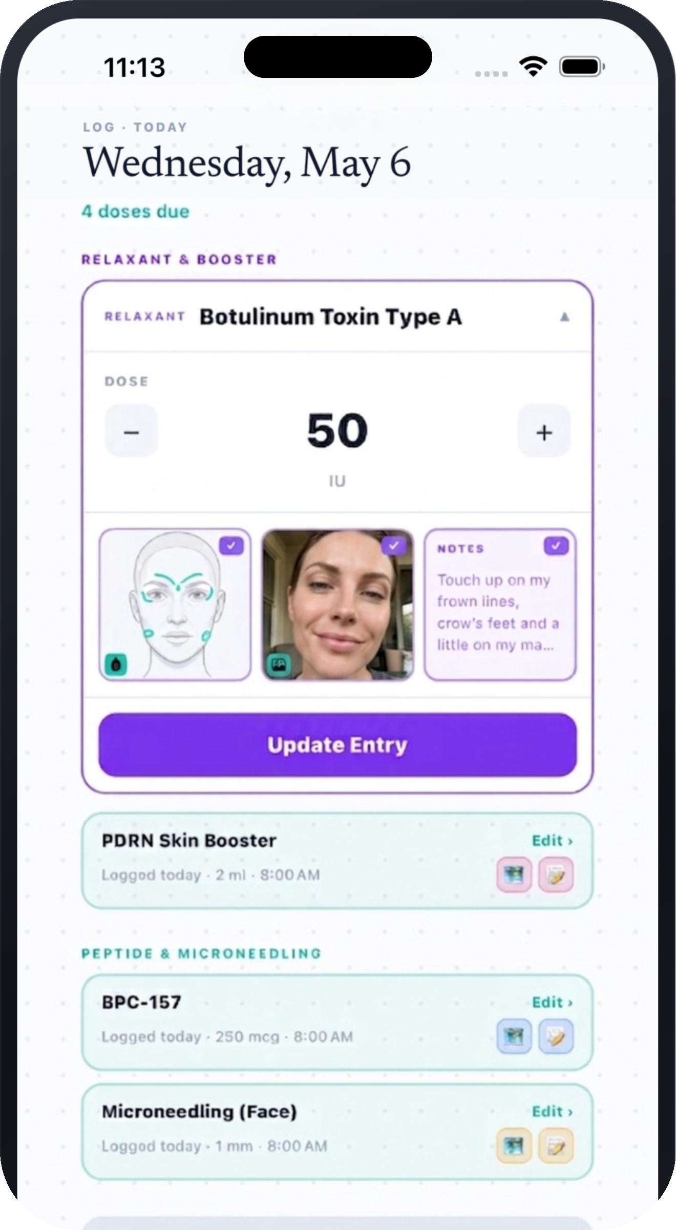 Dosefi log entry with face map, photo, and notes